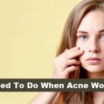 What Need To Do When Acne Wont Clear